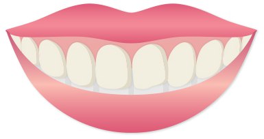 치열은 고르지만 치아 표면이 얼룩덜룩하게 변색된 웃는 입 일러스트